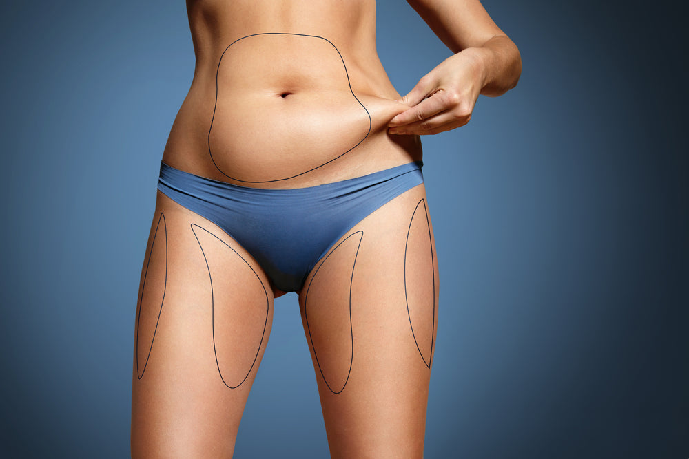 liposuction recovery time
